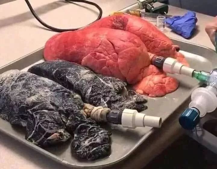 香港全面禁止销售电子烟_电子烟危害健康 禁止电子烟 国家 烟草危害