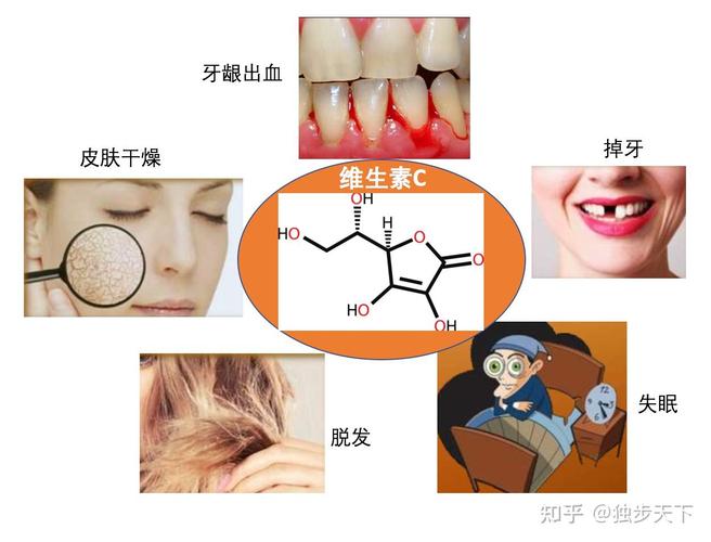 水溶性维生素和脂溶性维生素的区别_维生素作用及缺乏症状_维生素概念股票